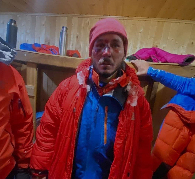 Альпинисты получили сильное обморожение